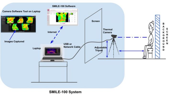Breast Thermal Imaging Method